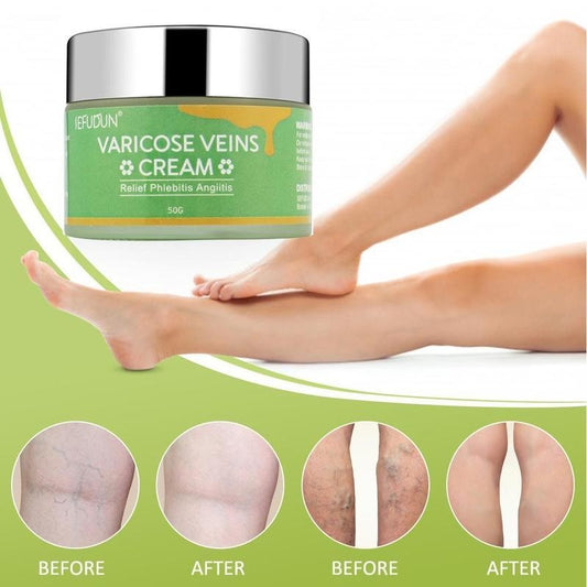 Varicose & Vein Relief Cream